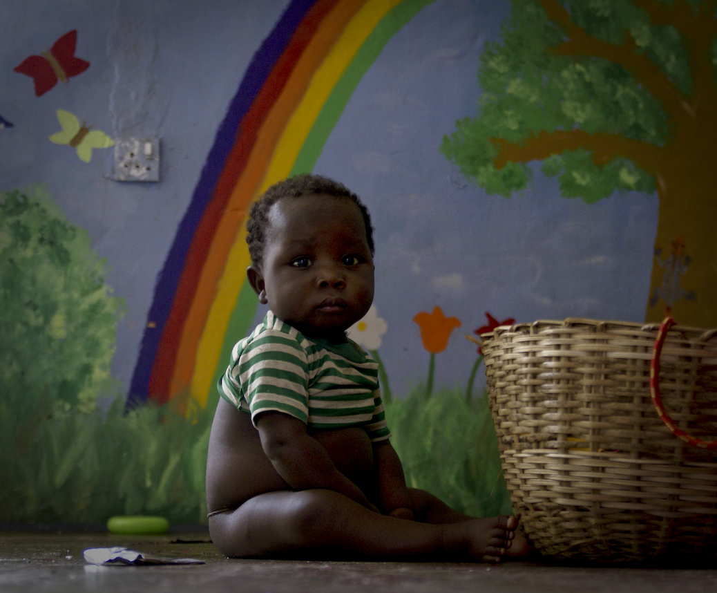 malnutrition sierra leone masanga children